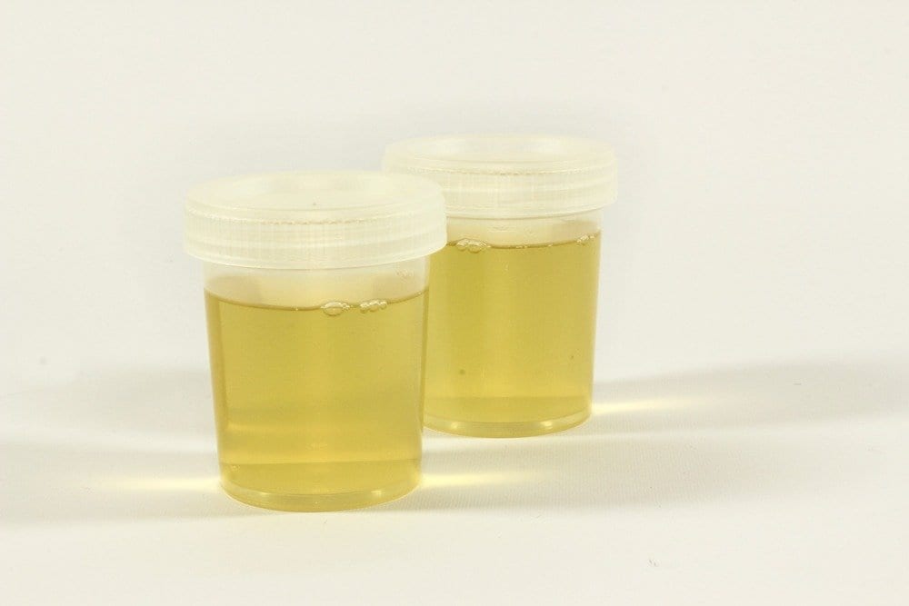 thc in urine