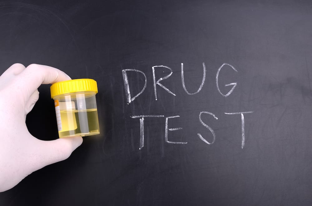 How to Pass a Urine Drug Test in 24 Hours Leafbuyer