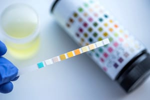 to think about how accurate home drug tests are this is a photo of test strip next to the drug test bottle key for which colors signify which drug is present
