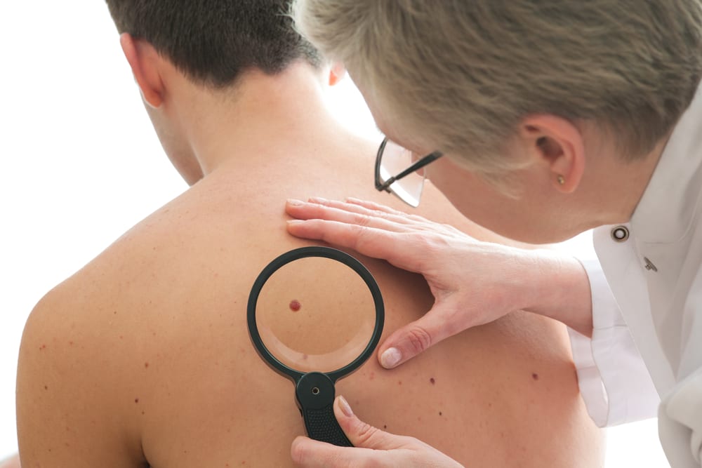 patient being examined for skin cancer, which could help us find out does marijuana kill cancer cells