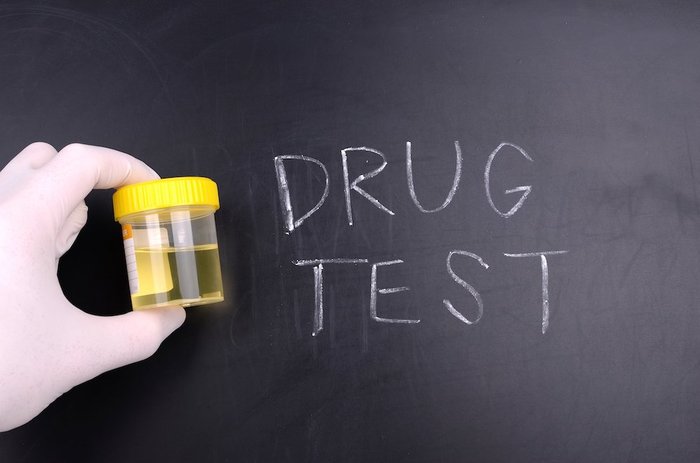 Cup of Urine for Drug Test Cup of Urine for Drug Test