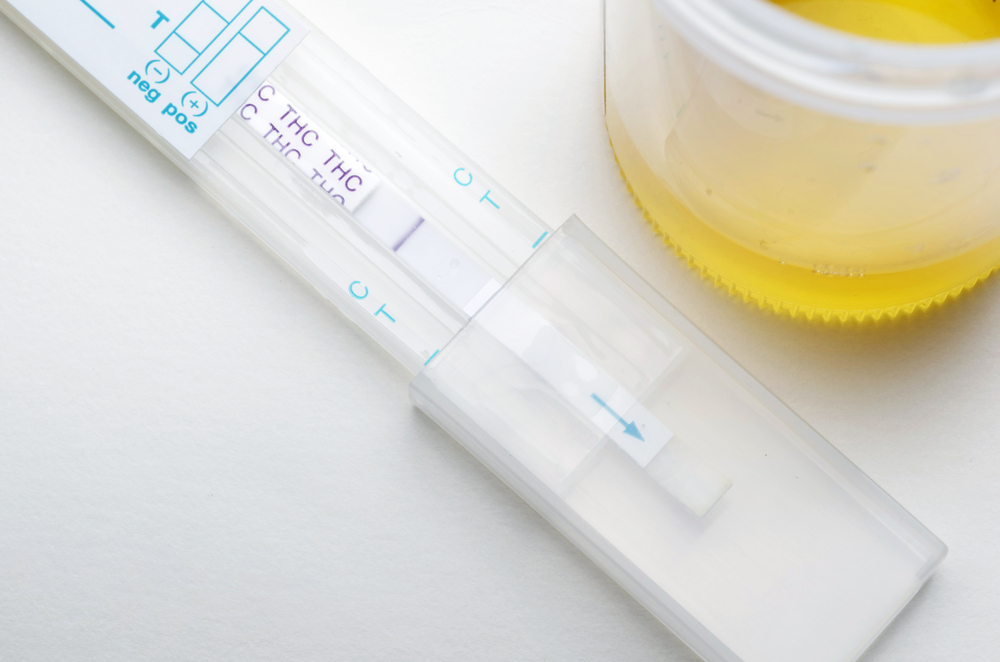 thc urine test